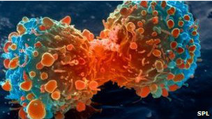 A pesquisa mostrou resultados em um determinado tipo de câncer de pulmão.